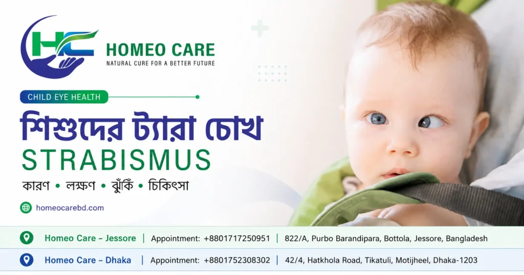 শিশুদের ট্যারা চোখ বা Strabismus: কারণ, লক্ষণ, ঝুঁকি, চিকিৎসা ও হোমিওপ্যাথিক অ্যাপ্রোচ